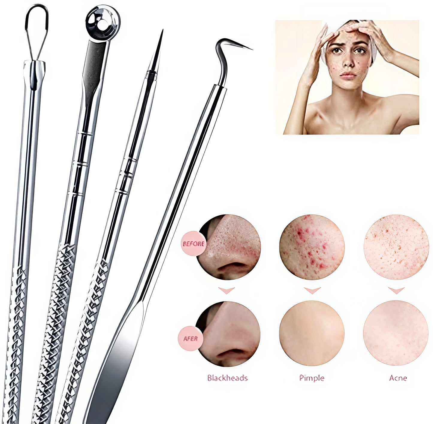 Stainless Steel Blackhead Remover Pimple Blemish Extractor Remover Tool Set